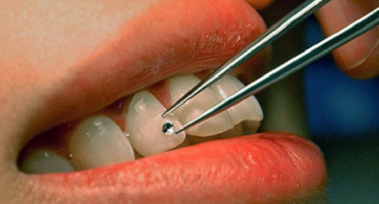 Сегодня отмечается Международный день зубного врача